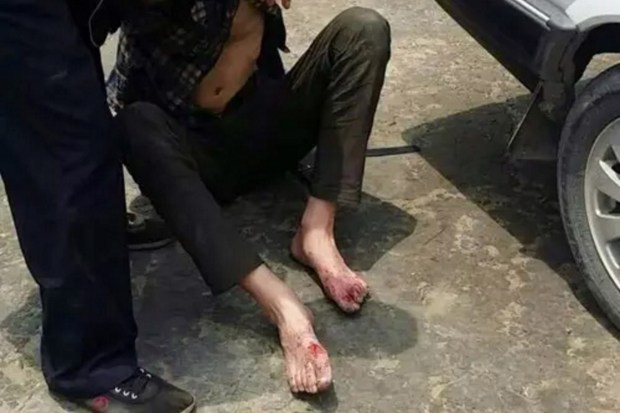 Gamer with rotting feet