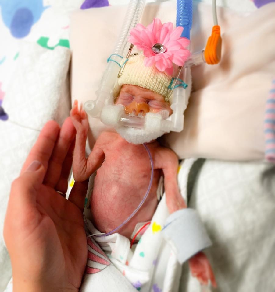 Cadence when she was 26 days old