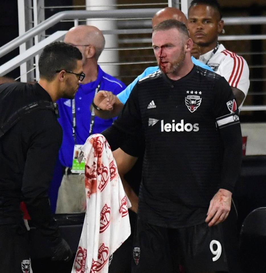 Wayne Rooney required five stitches and suffered a broken nose after the clash