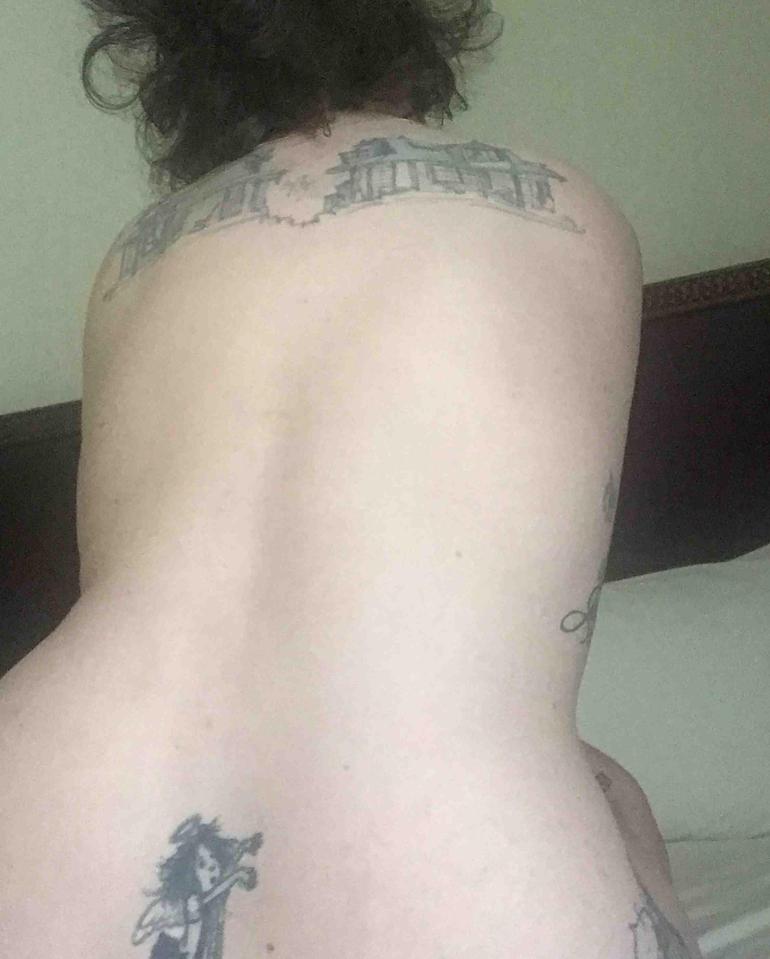  Lena has spoken openly about the major procedure, which she had to stop the unbearable pain she suffered because of endometriosis