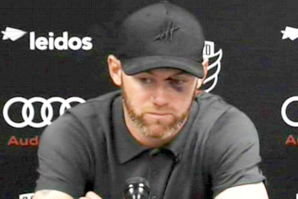 Wayne Rooney showed off his black eye following horror collision