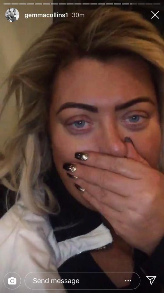  The star was left 'in agony' after falling again during last night's dress rehearsal