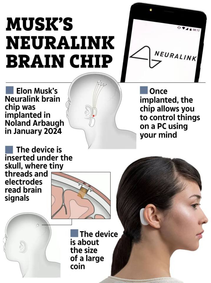 a poster about musk 's neuralink brain chip