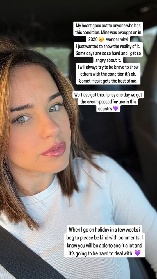 Close-up of a woman sharing her experience with an incurable condition.