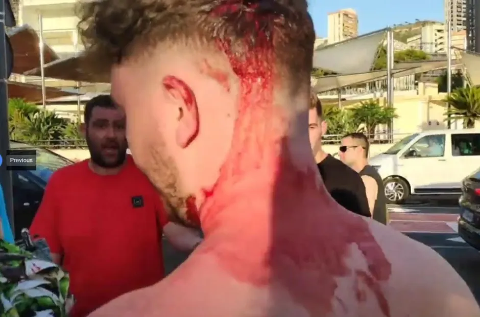 Man with bloody head and neck wounds.