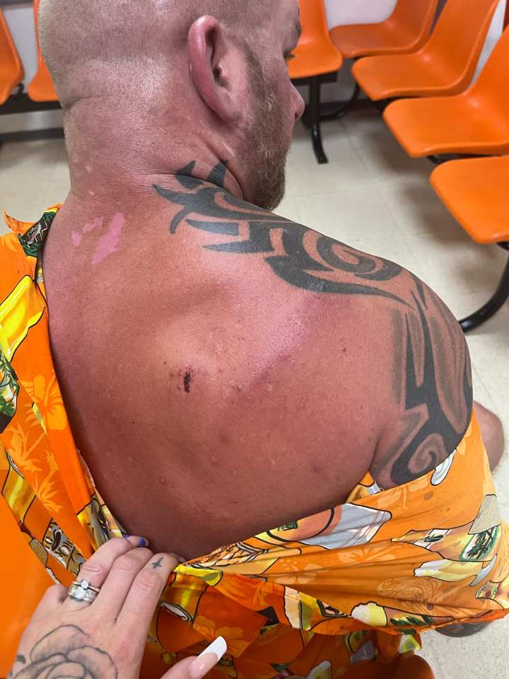 Close-up of a man with facial injuries.