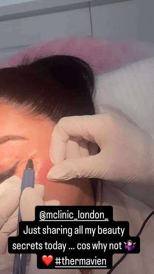 Close-up of a person's face receiving a beauty treatment.