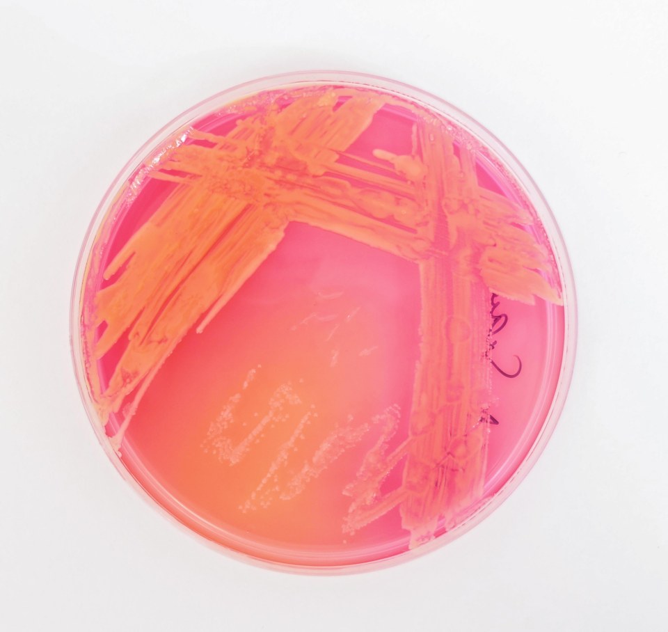 Test results . . . petri dish swarming with bugs taken from hand bags