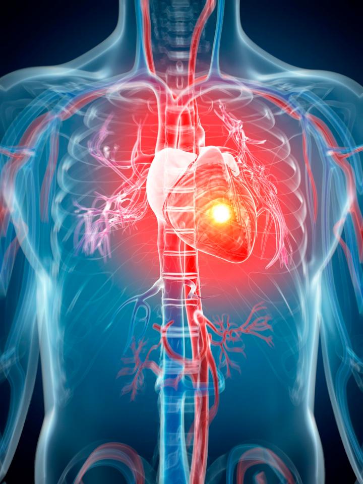 A cardiac arrest occurs when the heart suddenly stops beating