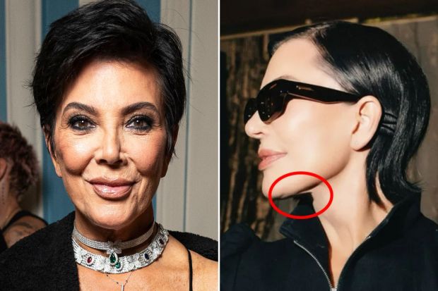 An image collage containing 2 images, Image 1 shows Kris Jenner at a fashion show, Image 2 shows Kris Jenner's neck and jawline